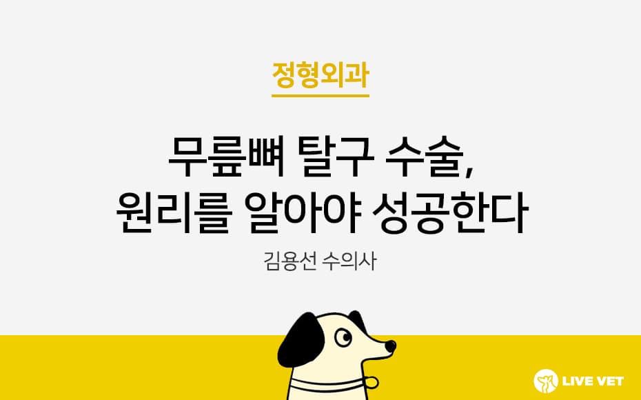 무릎뼈 탈구 수술, 원리를 알아야 성공한다
